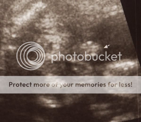 IMG1.jpg 20 weken boefje picture by selmamar