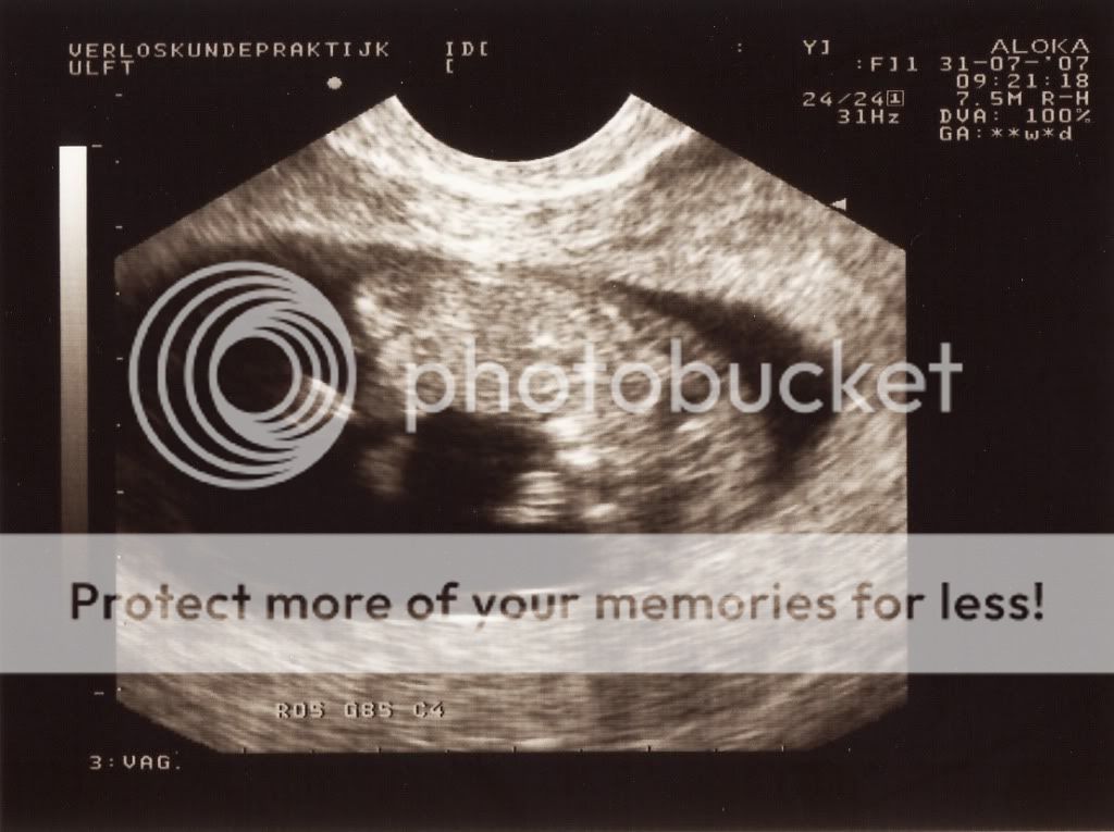 IMG_0001-1.jpg picture by selmamar