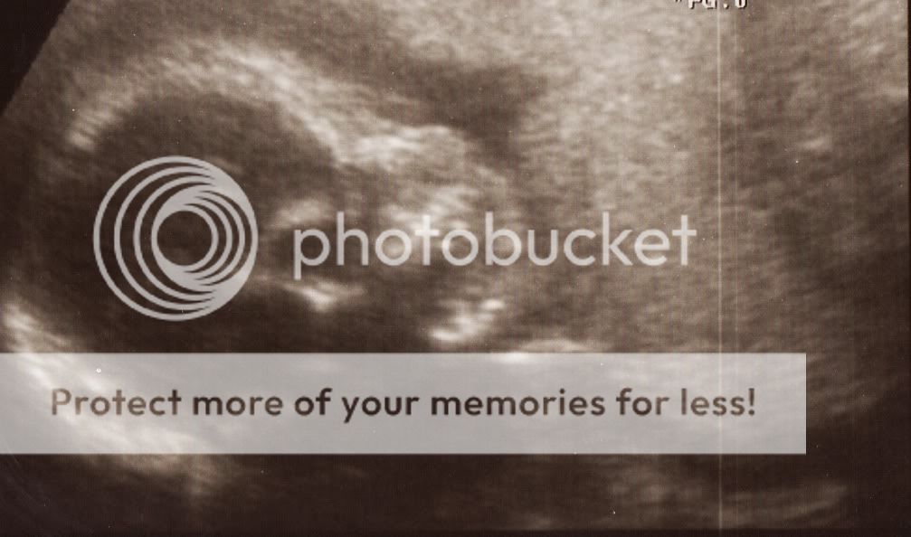 IMG_00011.jpg 20 weken boefje picture by selmamar